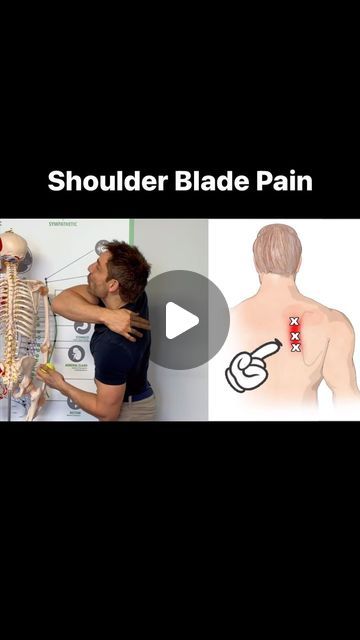 James The Osteopath on Instagram: "Here is how to get rid of shoulder blade pain. #ShoulderBladePain #BackPain #rhomboidpain" Knots In Shoulder Blade, Shoulder Blade Stretches For Pain, Pain Between Shoulder Blades, Shoulder Blade Pain, Shoulder Stretches, Shoulder Pain, Back Pain, On Instagram, Quick Saves