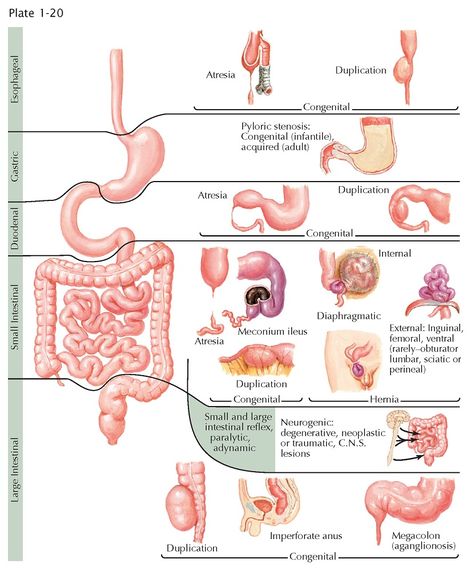 Superior Mesenteric Artery Syndrome, Superior Mesenteric Artery, Parasitic Worms, Large Bowel, School Science Projects, Metabolic Disorders, Bile Duct, Digestive Tract, Large Intestine