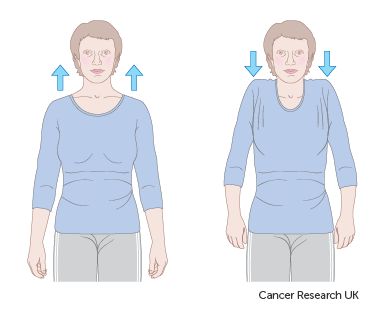 Mastectomy Exercises, Breast Firming Exercises, Mastectomy Recovery, Bilateral Mastectomy, Latissimus Dorsi, Breast Reconstruction, Breast Workout, Clean Lifestyle, Reconstructive Surgery