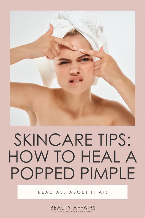 We all know that ideally, you should never, ever pop your breakouts - no matter how tempting it might be! Pimple popping is something that’s best left to the professionals, and for good reason.  However, you’re probably here reading this because you’re either trying to decide whether to pop a pimple, or the damage is a Popping Pimples, Blind Pimple, Post Inflammatory Hyperpigmentation, Prevent Pimples, Skin Care Quiz, Best Skin Care Routine, Scar Removal, Scarring, Skin Repair