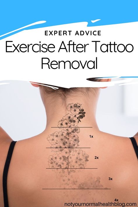 If you're having a tattoo removed you want the process to go as smoothly, and quickly, as possible and taking a break from your normal workouts is a part of that - but why is this - and how long do you need to take a break for? We asked an expert laser surgeon for their advice. After Tattoo, Laser Tattoo Removal, Best Spa, Taking A Break, Healthy Beauty, Tattoo Removal, Too Soon, But Why, Take A Break