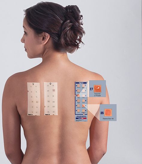 T.R.U.E. TEST Patch Test Panels | SmartPractice Dermatology/Allergy Study Storage, Dosage Form, Skin Patches, Pharmacology, Dermatology, Allergies, Nursing, Collage, Skin