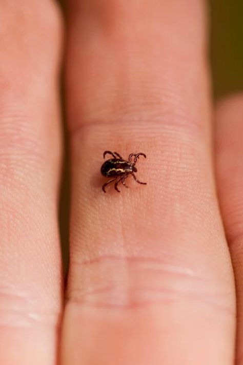 If you find a tick buried in your skin after a long day outdoors, the natural reaction might be to panic and rip it out. Lyme disease, alpha gal, Rocky Mountain spotted fever, and other tick-borne illnesses are no joke. But knowing how to remove a tick quickly and safely can be the difference between a harmless bite and an infection. Get Rid Of Ticks, Alpha Gal, Tick Removal, Tick Bite, Mid Century Fashion, Tweezers Eyebrows, Cleaners Homemade, Don't Leave, Cat Face