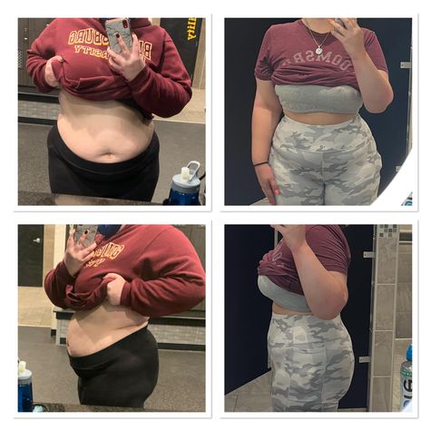 Here we have a progress pic showing a weight loss from 320 pounds to 170 pounds. That's a respectable loss of 150 pounds. 170 Pounds, 170 Lbs, User Story, 150 Pounds, 150 Lbs, Progress Pictures, Fat Loss, Medical, Crop Tops