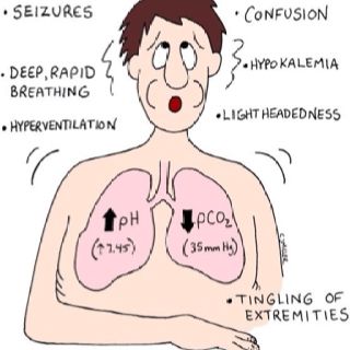 Respiratory Alkalosis #nclex #nursing #nclexreview Respiratory Nursing, Nursing Respiratory, Respiratory Alkalosis, Nclex Tips, Nursing Study Tips, Nursing Board, Nursing Assessment, Nclex Review, Nclex Prep