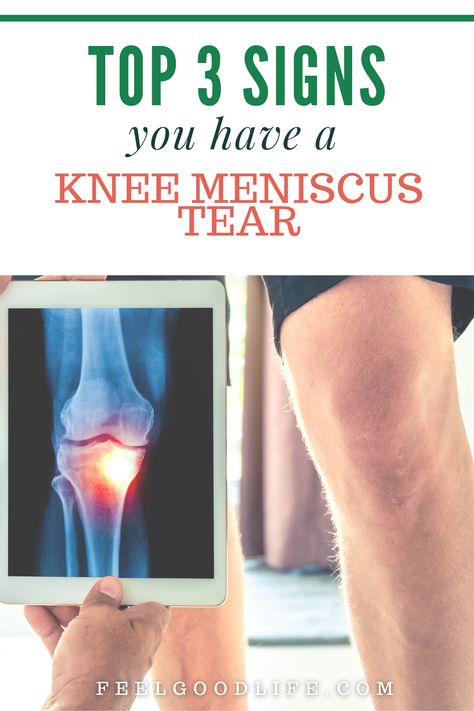 Knee Meniscus, Aching Knees, Knee Pain Relief Exercises, Inner Knee Pain, Knee Ligaments, Knee Strengthening Exercises, How To Strengthen Knees, Knee Problem, Knee Pain Exercises