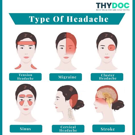 Types Of Headaches Chart, Hacks For Hair, Headache Chart, Type Of Headache, Remedy For Sinus Congestion, Hacks For Girls, Home Remedies For Sinus, Throbbing Headache, Migraine Prevention