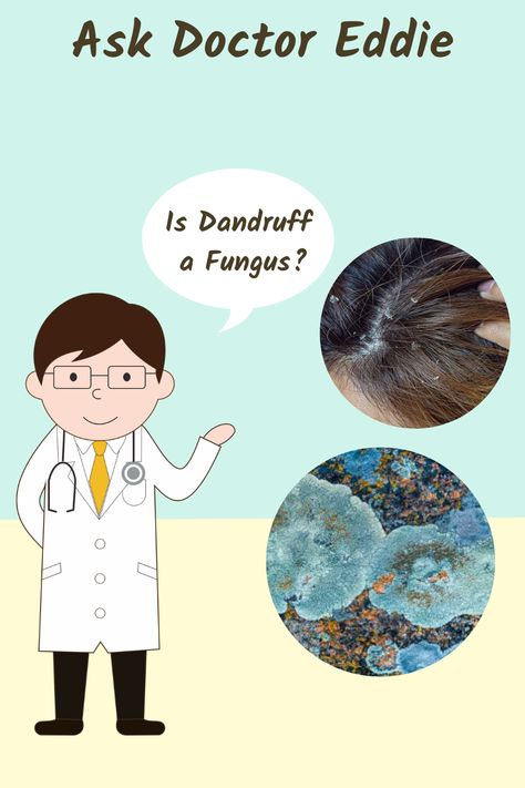 Do you have flakes or scales on your scalp and are not sure if it could be caused by Yeast or a fungus 🤔 Follow the link to read the article written by Dr. Eddie 👨‍⚕️ and learn all about Dandruff. What Causes Dandruff, Carboxylic Acid, Getting Rid Of Dandruff, Scaly Skin, Excess Skin, Scalp Oil, Anti Dandruff Shampoo, Young Skin, Licorice Root Extract