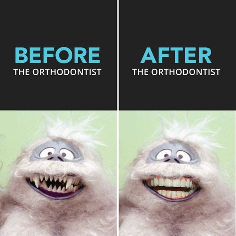 Orthodontics Marketing, Dental Social Media, Dental World, Dental Posts, Dental Jokes, Dental Fun, Dentist Humor, Dental Facts, Dental Marketing