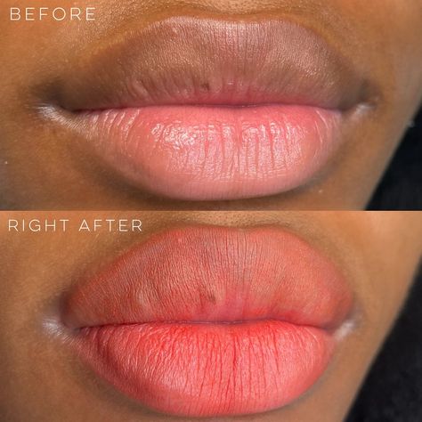 Lip Blushing Tattoo Before And After, Lip Neutralization, Blush For Dark Skin, Lip Blushing, Dark Lip, Peach Lips, Lip Blush, Small Lips, Lip Tattoos