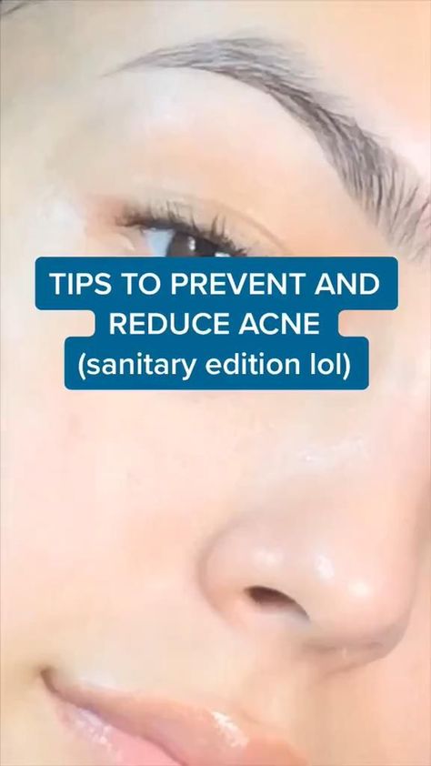 How To Reduce Acne On Face, Tips To Prevent Acne, How To Wash My Face, How To Prevent Acne Breakouts, Skincare For Breakouts, How To Reduce Acne And Pimples, How To Get Rid Of Breakouts, How To Get Rid Of Face Redness, How To Get Rid Of Pimples Naturally