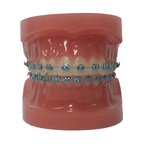 Brace Colors, Braces Colours, Dental Braces Colors, Braces Colors Combinations, Braces Ideas, Braces Colors Ideas, Braces Food, Braces Bands, Cute Braces Colors