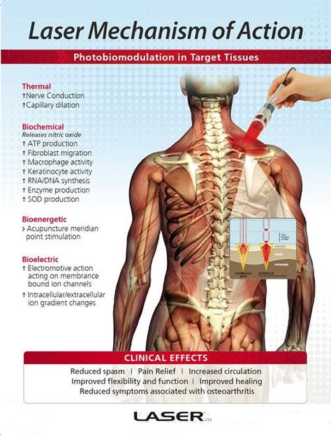 Cold lasers work on many levels and not only heal, but prevent disease and injury, especially when you add reflex integration. Reflex Integration, Decompression Therapy, Types Of Injuries, Meridian Points, Cold Laser Therapy, Low Level Laser Therapy, Spinal Decompression, Power Plate, Complex Regional Pain Syndrome