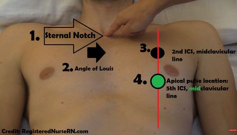 Learn how to assess the apical pulse. This article will explain how to find the apical pulse location along with how to listen and palpate the apical pulse. As a nurse you will be assessing the api… Pulse Locations Nursing, Apical Pulse Location, Apical Pulse, Lpn School, College Things, Lpn Schools, Student Tips, Nursing Life, Nursing Mnemonics