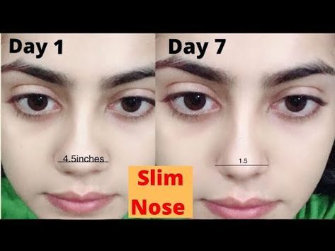 How to get slim, sharp and erect Nose Best exercise for Nose Sliming | Get rid of big nose - YouTube How To Get Slim, Nose Types, Nose Reshaping, Pretty Nose, Turmeric Vitamins, Face Yoga Facial Exercises, Facial Yoga, Health Guru, Best Exercise