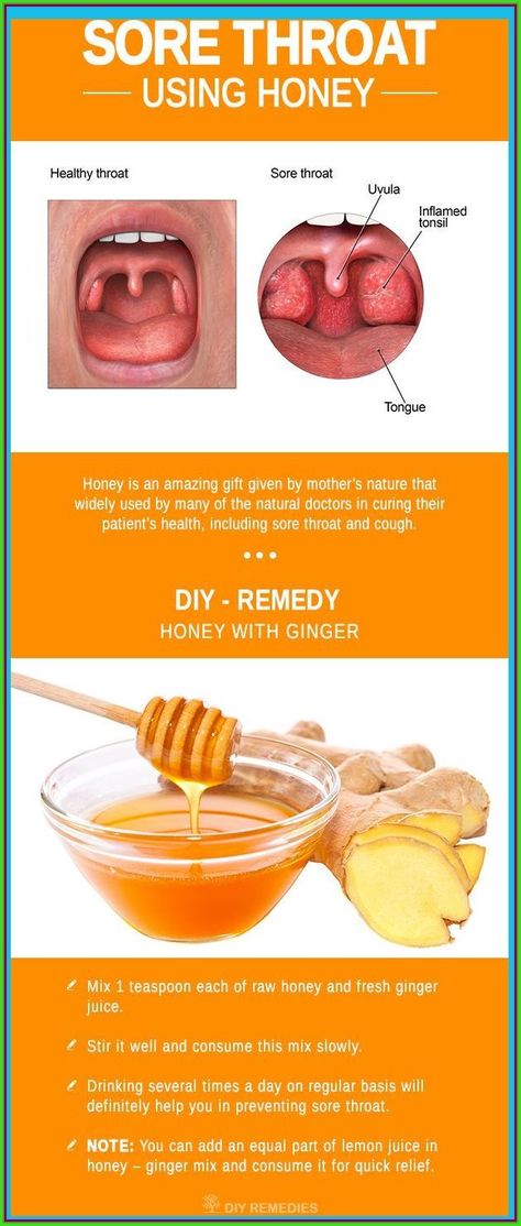 How to Use Honey for Sore Throat? Honey For Sore Throat, For Sore Throat, Throat Remedies, Sore Throat Remedies, Sore Throat And Cough, Canker Sore, Ginger Juice, Diy Remedies, Natural Cough Remedies