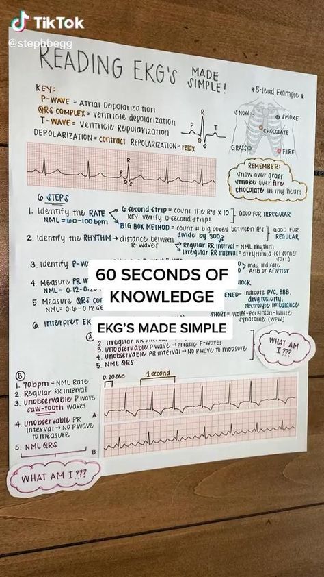 Ekg Basics Nursing, Nursing Hacks Tips, Medical Terminology Nursing, Medical Assistant Books, Epic Charting System Nursing, Hosa Medical Club, How To Study For Nursing School, Mods Nursing, Medical Books To Read