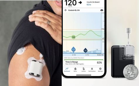 Health Gadgets, Insulin Pump, Study Board, Tandem, Cool Gadgets, Cool Things, Cool Stuff, Ios, Gadgets