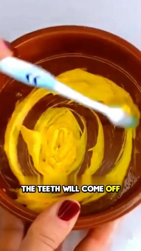 1.9K views · 111 reactions | Sharing to you the natural recipe to remove tartar and whitens the teeth in just 1 minute only...watch to discover! | By Ruel Ilagan Magallanes | Teeth whitening and tartar removal at home in 1 minute. Dentists will never reveal this secret. You will smile again. First, put half a teaspoon of Vaseline in a bowl. Vaseline whitens your teeth and leaves them shining like pearls. Tell me in the comments where you're from, I'd like to know. Add a teaspoon of toothpaste. Add/ 2 a teaspoon of turmeric. Turmeric not only whitens teeth but also treats and reduces gum inflammation, relieving tooth pain. Add a few drops of lemon juice as lemon brightens teeth and eliminates bad breath. Mix all the ingredients well and brush your teeth thoroughly with this mixture for 1 mi Tartar Removal, Brighten Teeth, Gum Inflammation, False Teeth, Brush Your Teeth, Tooth Pain, The Teeth, Vaseline, Natural Food