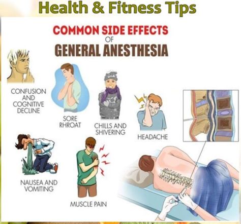 Side Effects of General Anesthesia You Must Know. General Anesthesia, General Anaesthesia, Nurse Anesthetist, Muscle Pain, Health And Fitness Tips, Nursing School, Side Effects, Headache, Fitness Tips