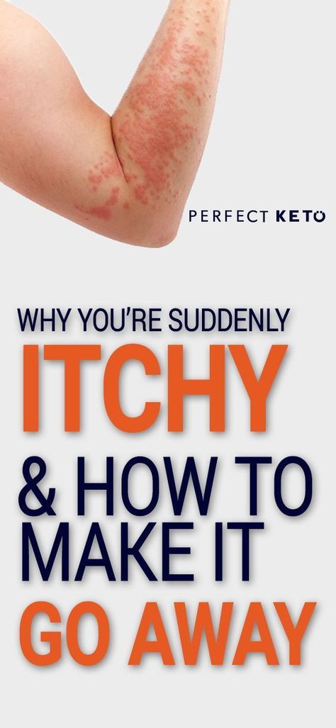 Keto Rash, Keto Basics, Rash Causes, Nutrition Therapy, Vegan Keto Diet, Keto Diet Results, Keto Diet App, Men Health, Keto Diet Benefits