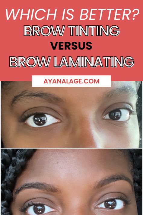 The best tips and everything you need to know about brow tinting! I am sharing my brow tinting before and after and explaining why I prefer it to brow laminating! Eyebrow Lamination Before And After, Brow Lamination Before And After, Sunburn Peeling, Eyebrow Before And After, Henna Eyebrows, Eyebrows Microblading, Brow Threading, Dark Eyebrows, Natural Face Care