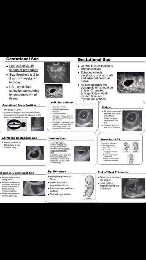 Sonography Student Notes, Sonography Student Study Obgyn, Ultrasound Tech Study Notes, Medical Sonography Student, Ardms Obgyn, Sonography Notes, Sonography Student Study, Obgyn Sonographer, Ultrasound Humor