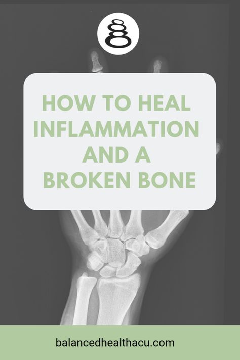 How to Heal Inflammation and a Broken Bone — Balanced Health Acupuncture - Marion, MA Bone Healing Foods, Broken Fibula, Strengthen Joints, Wrist Fracture, Ankle Recovery, Heal Broken Bones, Heal Inflammation, Fracture Healing, Knee Bones