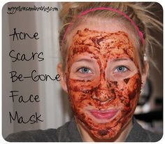 Acne Scars Be Gone Face Mask  I'm really interested in this one cuz I have dark spots and acne scars but I cannot afford the very expensive dark mark/acne scar corrector creams!  1/2 tsp cinnamon,1/2 tsp nutmeg,1 tsp honey,2 tsp lemon juice  Mix to a paste, apply, leave on up to 30 mins. Will burn the first 5, if you can't handle the burn, omit lemon juice. Burning Face Mask, Obličejové Masky, Makeup Tip, Natural Face Mask, Astringent, Beauty Remedies, Mascara Facial, The Burning, Diy Beauty Hacks