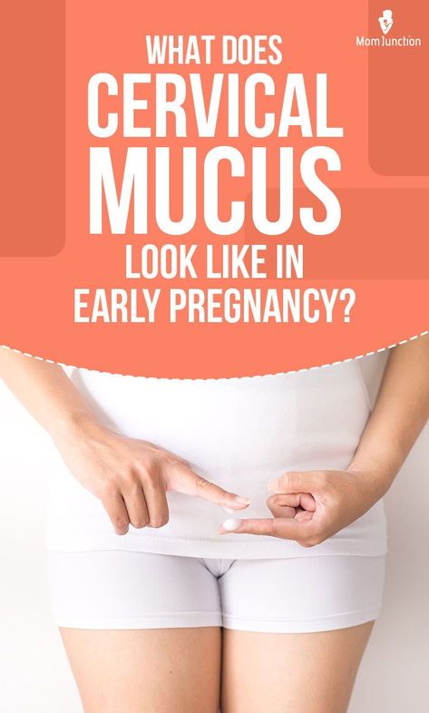 Several changes may occur in the cervical mucus in early pregnancy. Many women may use these changes as a marker to guess if they have conceived or not, even before they go for a home pregnancy test. Cervical Mucus Before Period, Cervical Mucus Cycle, Cervical Mucus After Ovulation, Best Stretch Mark Removal, Mucus Plug, Cervical Mucus, Home Pregnancy Test, Early Pregnancy Signs, Female Health