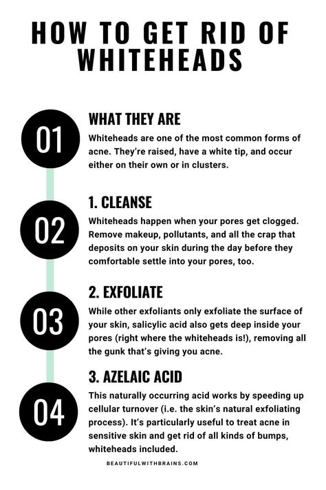 Whiteheads driving you crazy? Dive into this article to uncover scientifically proven tips that will help you bid farewell to those unwelcome visitors. Click through to learn how to achieve a clear, blemish-free complexion.  Discover effective strategies to eliminate whiteheads and achieve clear skin.  About: skincare solutions, blemish removal How To Get Rid Of White Heads, Whiteheads Removal Remedies, Whiteheads On Chin, Vaseline Hacks, Whiteheads Removal, Healthy Hygiene, Head Acne, The Ordinary Azelaic Acid, How To Remove Blackheads