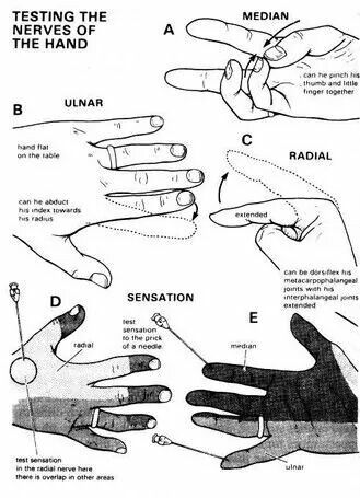 Hand Nerves, Massage School, K Tape, Remedial Massage, Median Nerve, Pediatric Therapy, Hand Therapy, Occupational Therapist, Physical Therapist