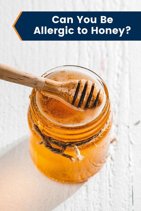 If you have bee sting allergies, have you also wondered if you could be allergic to honey? Find out the most likely causes of honey allergies. Sun Allergy, Improve Nutrition, Allergy Testing, Bee Sting, Can You Be, Raw Honey, Allergies, Honey, Bee