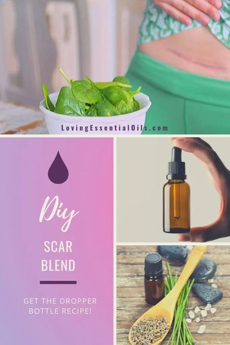 Best Oil for Scars with DIY Recipes by Loving Essential Oils Essential Oils For Scars After Surgery, Holistic Skincare, Oils For Scars, Healing Skin, Helichrysum Essential Oil, Diy Essential Oil Recipes, Winter Skincare, Homemade Essential Oil, Diy Recipe