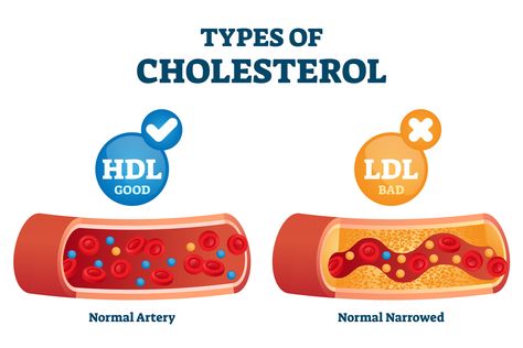 Remedies For High Cholesterol, Hdl Ldl, Fat Coffee, Good Cholesterol, Egg Nutrition, Bad Cholesterol, Healthy Cholesterol Levels, Teaching Biology, Natural Antibiotics