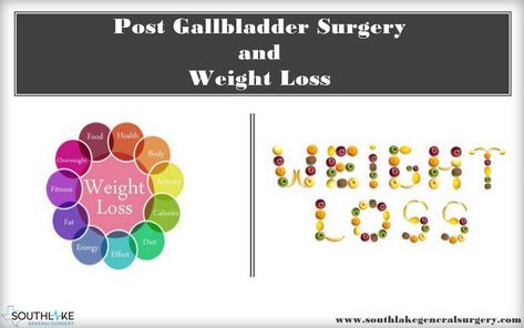 A patient may experience fluctuations in body weight or maybe weight loss post-gallbladder surgery. Weight loss after gallbladder surgery is observed in a few individuals. Let's explore more: https://www.southlakegeneralsurgery.com/weight-loss-post-gallbladder-surgery/ Gallbladder Surgery Diet, After Gallbladder Surgery, Gallbladder Surgery, General Surgery, Put On Weight, Maintain Weight, Healthy Body Weight, After Surgery, Post Surgery