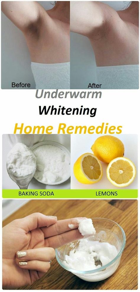 Whiten Armpits, Whiten Underarms Fast, How To Whiten Underarms, Baking Soda And Lemon, Dark Armpits, Dark Underarms, Hair Diy, Baking Soda Shampoo, Natural Cleanser