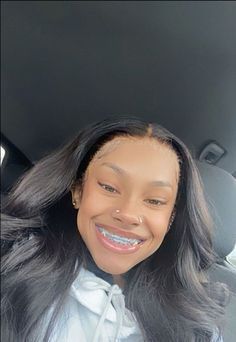 #teenfiction Braces Manifestation, Baddie Selfie, Harlem Nyc, Braces Girls, Cute Braces, Dd Osama, Nice Smile, Cute Box Braids, Brace Face