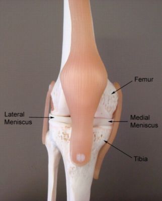 Medial Epicondyle, Medial Meniscus, Meniscus Surgery, Meniscal Tear, Surgical Technician, Human Skeleton, Medical Art, Knee Injury, Occupational Therapy