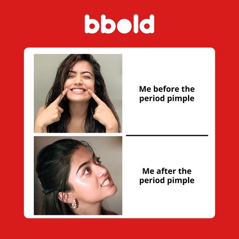 Before the period pimple: a low-budget horror film on my face. You can prevent this by using our Bbold Acne Patch. Because confidence deserves a blockbuster finale! 🎬✨ #BboldGlowUp #pimple #bbold #bboldacnepatch #bboldhygine #bboldproducts Period Pimples, Acne Patch, Menstrual Health, Horror Film, Low Budget, Horror Films, Glow Up?, Budgeting, Period