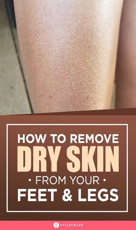 How To Remove Dry Skin From Your Feet And Legs: Is the dry, flaky skin on your feet and legs irritating you? Then, come aboard and resolve this skin issue with the remedies in this article. #Beauty #BeautyTips #DrySkin Dry Skin Legs, Dry Legs, Dry Flaky Skin, Dry Skin Care Routine, Skin Care Routine For 20s, Dry Skin Remedies, Dry Skin Care, Flaky Skin, Etude House