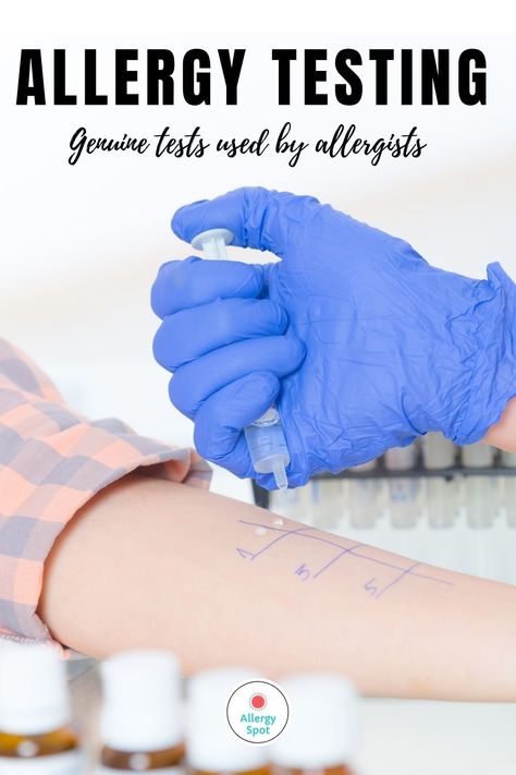 All about different types of allergy testing used by allergy specialists for IgE mediated allergies. Testing for food and other allergies. Bloods tests, skin prick tests, oral challenges and more. Also which types of tests are unproven and should be avoided. Blood Test Results, Peanut Tree, Hay Fever, Allergy Testing, Scrub Life, Support Groups, Allergy Symptoms, Food Challenge, Food Allergy