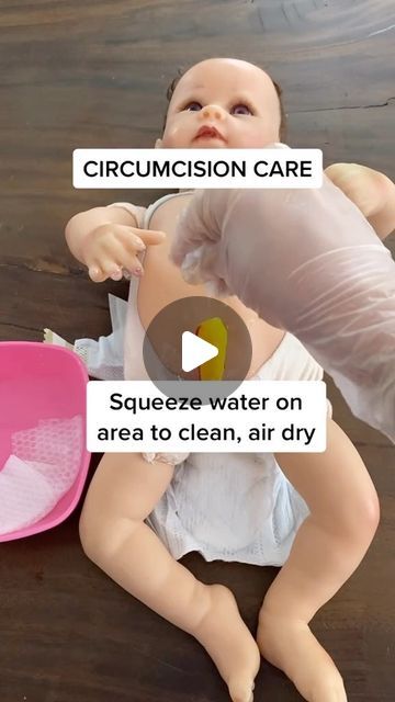 Baby Circumcision Care, Newborn Circumcision Care, Circumcision Care Newborn, Jaundice Newborn, Baby Information, Baby Education, Nursing Baby, Baby Tips, Post Baby