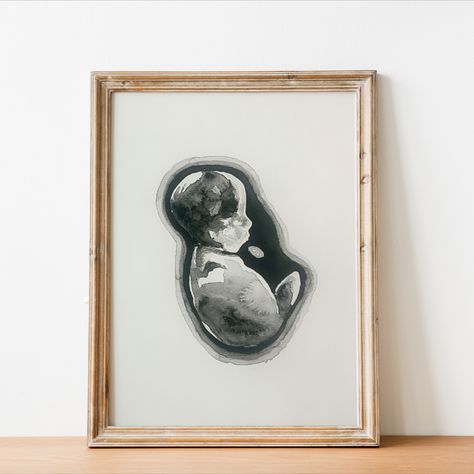 Looking for an unforgetable baby gift or commemoration? Check out these custom hand-made ultrasound paintings delivered to you! Ultrasound Painting, Small Business Gift Ideas, Cottage Modern, Custom Nursery, Modern Scandinavian, Custom Watercolor, Farmhouse Style Decorating, Scandinavian Home, Ultrasound