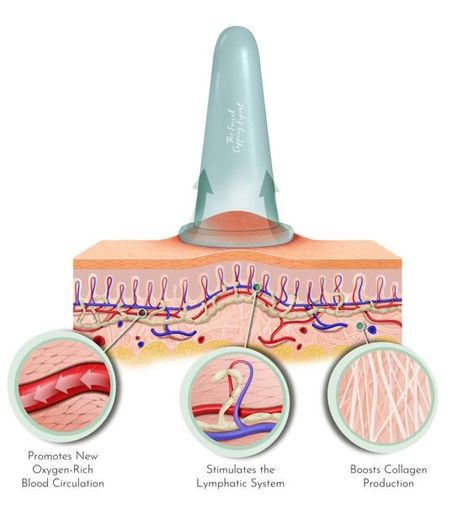 Facial Cupping Benefits, Facial Cupping Before And After, Cupping Placement Chart, Cupping Points, Face Cupping, Facial Massage Steps, Hijama Cupping, Facial Massage Techniques, Remove Skin Tags Naturally