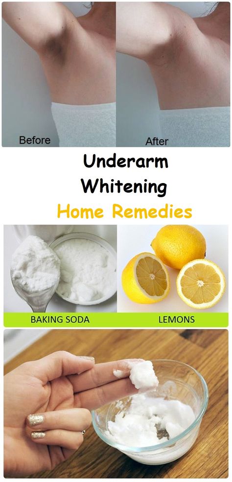 Obličejové Masky, Dark Underarms, Dark Skin Beauty, Beauty Remedies, Skin Remedies, Skin Care Remedies, Diy Skin, روتين العناية بالبشرة, Skin Tips