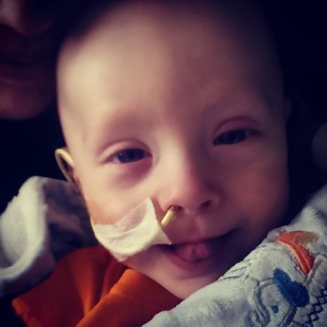 Dear Mom of a New Tubie, So your sweet, precious child just got a feeding tube. Whether that’s an NG tube, GJ Tube, PEG G-Tube, Button G-Tube or some other kind I don’t know about; you now have a t... Nasogastric Tube, Feeding Tube Awareness, Ng Tube, Tube Feeding, Sister Bear, Parenting Jokes, Chd Awareness, Parenting Plan, Feeding Tube