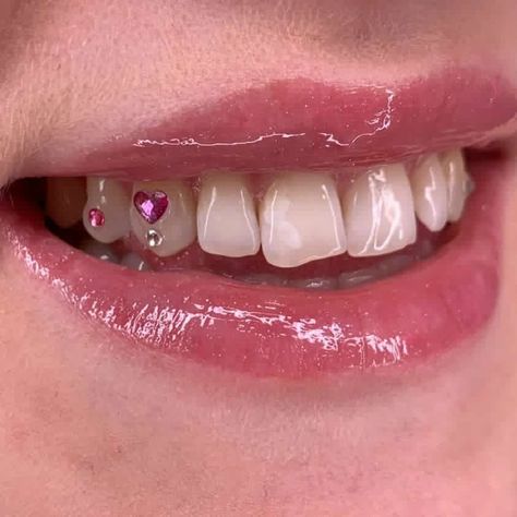 Simple Tooth Gem Designs, Pink Tooth Gem, Tooth Gem Designs, Teeth Gems, Pretty Teeth, Dental Jewelry, Diamond Teeth, Tooth Gems, Grills Teeth