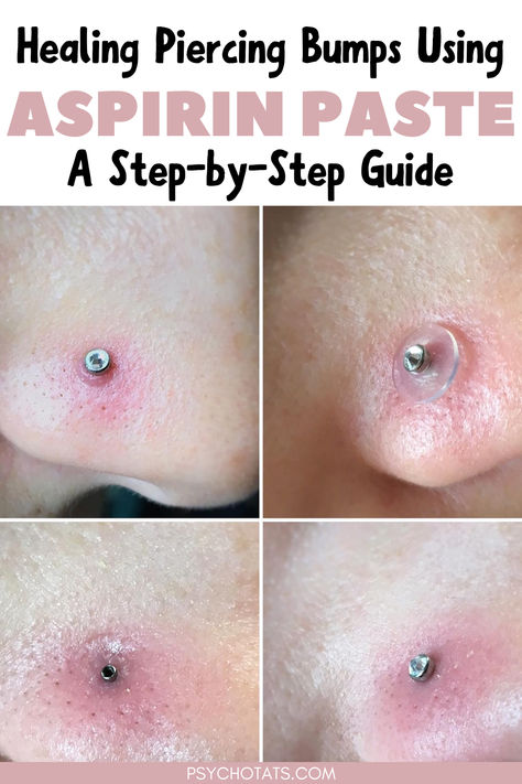 aspirin paste for piercing bump How To Get Rid Of A Piercing Bump, Piercing Bump Remedy, How To Get Rid Of Nose Piercing Bump, How To Heal Nose Piercing Bump, Nose Piercing Irritation Bump, Irritation Bumps Piercing, Nose Piercing Bump, Piercing Bump, Piercing Shop