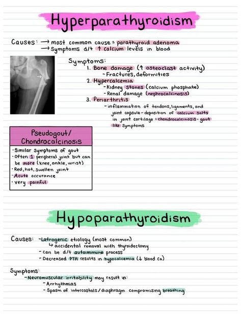 Hyperparathyroidism vs Hypoparathyroidism #medicalschool #resources #medicalstudent - Image Credits: Caroline Bontempo Preload Vs Afterload, Medical Notes, Nursing School Survival, College Advice, Nursing School Notes, Medical School Essentials, School Survival, Nursing Notes, Medical Knowledge